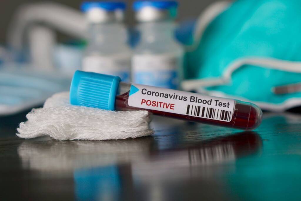 Coronavirus Manolo Gabbiadini